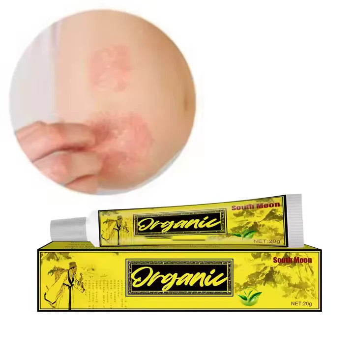 pommade organique et naturelle pour la peau – Eczéma