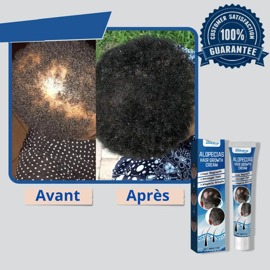 Alopécie Créme